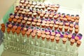 Test tubes for blood test Royalty Free Stock Photo