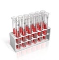 test tubes with blood on a tray, Royalty Free Stock Photo