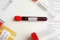 Test tubes and jars with samples on white table, above view. Doping control Royalty Free Stock Photo