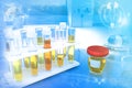 Urine sample test for doping or calcium carbonate - test tubes in modern pollution college clinic, medical 3D illustration