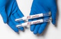 Test tubes with positive and negative result of HIV analysis in doctor hand Royalty Free Stock Photo