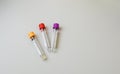 Test tubes rack with madical samples on the table at the modern laboratory Royalty Free Stock Photo