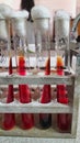 Test tubes in test tube stand