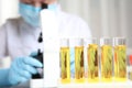 Test tubes with urine samples for analysis and doctor on background, closeup Royalty Free Stock Photo