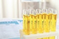 Test tubes with urine samples for analysis Royalty Free Stock Photo