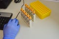 Test tubes with yellow caps next to the yellow holder. taking blood from a vein with a vacutainer. quick and painless diagnostics