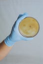 Testing for intestinal bacterial infection Royalty Free Stock Photo