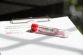 Testing kit for nCov, covid - 19, corona virus testing tube in laboratory Royalty Free Stock Photo