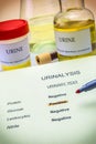 Tests for Research of urine Royalty Free Stock Photo