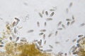 Tetrahymena is a genus of unicellular ciliated protozoan