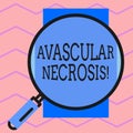 Text sign showing Avascular Necrosis. Conceptual photo death of bone tissue due to a lack of blood supply Round