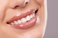 Thats a perfect smile. a womans perfect smile against a gray background. Royalty Free Stock Photo