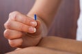 Therapist performing acupuncture treatment