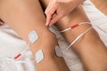 Therapist placing electrodes on woman's knee