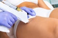 Therapist reducing cellulite with micro needle technology on female thigh