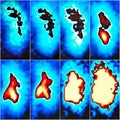 Nuclear renal scan eight images function collage