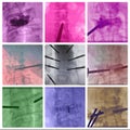 Radiofrequency ablation spinal vertebrae colorful collage