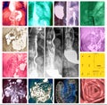 Gastroenterology system exams colorful collage