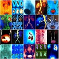 Colorful urological  diagnostic  imaging collage Royalty Free Stock Photo