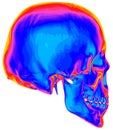 Thermal Image Of The Human Skull