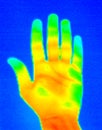 Thermograph-Hand Palm Royalty Free Stock Photo