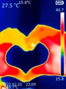 A thermographic image of a hand with a human heart, showing different temperatures in different colors, from blue indicating