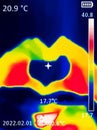 A thermographic image of a hand with a human heart, showing different temperatures in different colors, from blue indicating Royalty Free Stock Photo