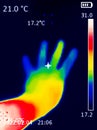 A thermographic image of a hand with a human heart, showing different temperatures in different colors, from blue indicating