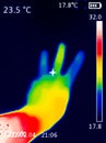 A A thermographic image of a hand with a human heart, showing different temperatures in different colors, from blue indicating Royalty Free Stock Photo