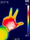Thermographic image of a person`s hand showing different temperatures in different colors, from blue indicating cold to red