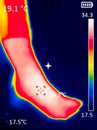 thermographic image of a person`s leg showing different temperatures in different colors, from blue indicating cold to red