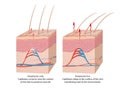 Thermoregulation of the human bod