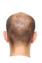 Thin hair Royalty Free Stock Photo