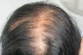 Thin hair and scalp problems and broken hair