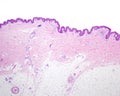 Thin skin. Hematoxylin-eosin