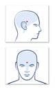 Third Eye Pineal Gland Epiphysis Cerebri Position Brain Anatomy