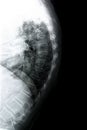Thoracic spine/side view Royalty Free Stock Photo
