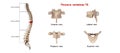 Thoracic vertebrae T8