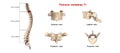 Thoracic vertebrae T1