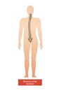 Thoraco Lumbar Scoliosis Composition Royalty Free Stock Photo