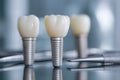 Three artificial dental implants with ceramic crowns displayed on a reflective surface alongside precision dental tools in a Royalty Free Stock Photo