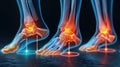 Three different types of foot pain, AI