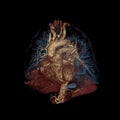 Three-dimensional color computed tomography image of the heart and lungs isolated on black