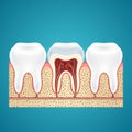 Three healthy human tooth