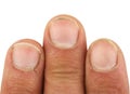 Three male fingers with dirt under the nails, closeup macro, isolated