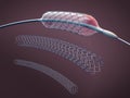 Three metal stents for implantation and supporting blood circulation into blood vessels and catheter Royalty Free Stock Photo