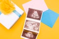 three snapshots of ultrasound on pink and blue envelopes, next to which is a silver box Royalty Free Stock Photo