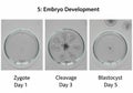 Three stages of embryo development: 1. **Zygote** (Day 1): A single cell with visible nucleus, Royalty Free Stock Photo