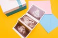 three ultrasound pictures on pink and blue envelopes, next to which is a silver box with a blue ribbon Royalty Free Stock Photo