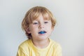 Three-year old boy shows myofunctional trainer to illuminate mouth breathing habit. Helps equalize the growing teeth and correct Royalty Free Stock Photo